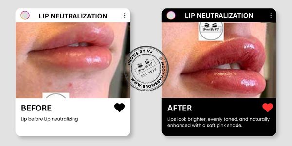 After Before Design (7)