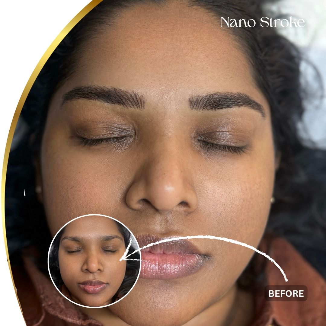 nano strock - 2