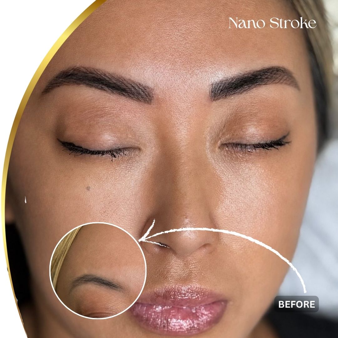 nano strock - 3