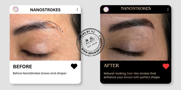 After Before nano stroke service