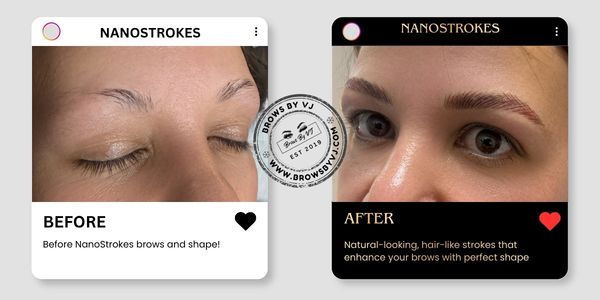 After Before nano stroke