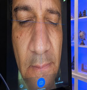 Skin analyzer